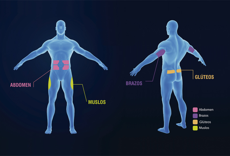 rotacion-inyeccion-diabetrics.jpg