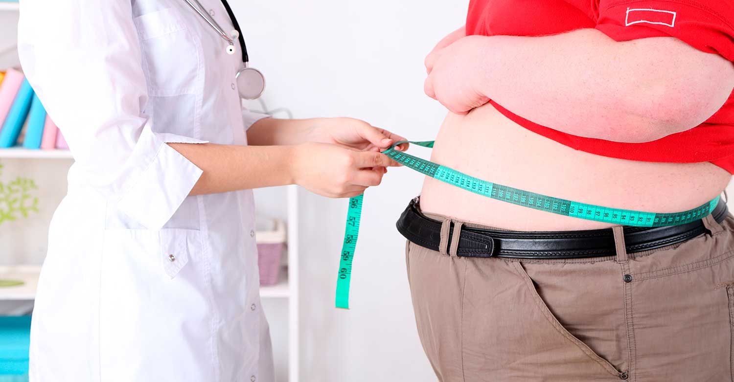 What you should know about obesity
